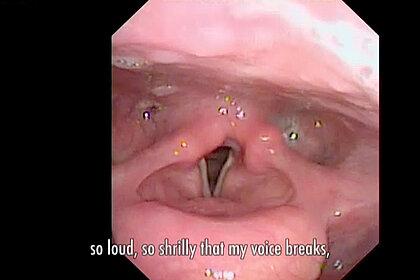 Stimmlippen (auch: Stimmfalten)
