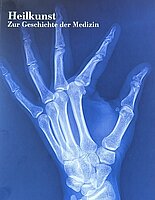 Cover des Katalogs Heilkunst. Auf dem Cover ist ein blaues Röntgenbild von einer Hand zusehen.